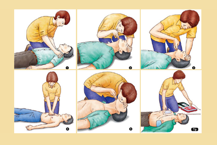 হার্ট অ্যাটাক হলে যেভাবে দেবেন সিপিআর 13 crp heart attack