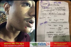 টঙ্গীতে মোটরসাইকেল রাখা নিয়ে বিরোধ: কলেজ ছাত্রকে পিটিয়ে গুরুতর জখম